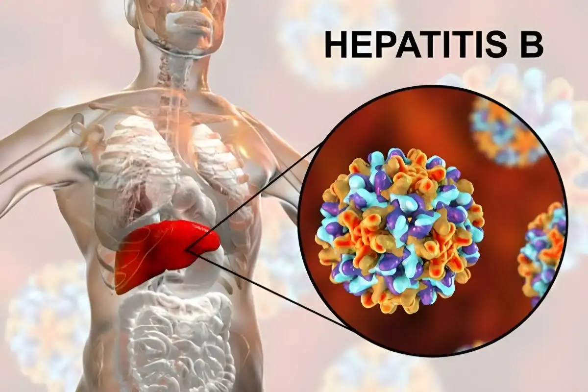 Mewaspadai Penularan Hepatitis B dari Ibu ke Anak Fakta yang Perlu Diketahui