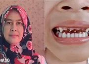Peran Vital Perawatan Gigi dan Mulut dalam Meningkatkan Kesehatan Otak Anak