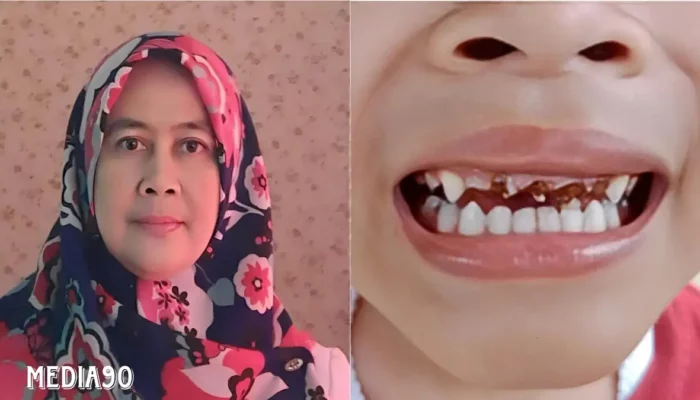 Peran Vital Perawatan Gigi dan Mulut dalam Meningkatkan Kesehatan Otak Anak