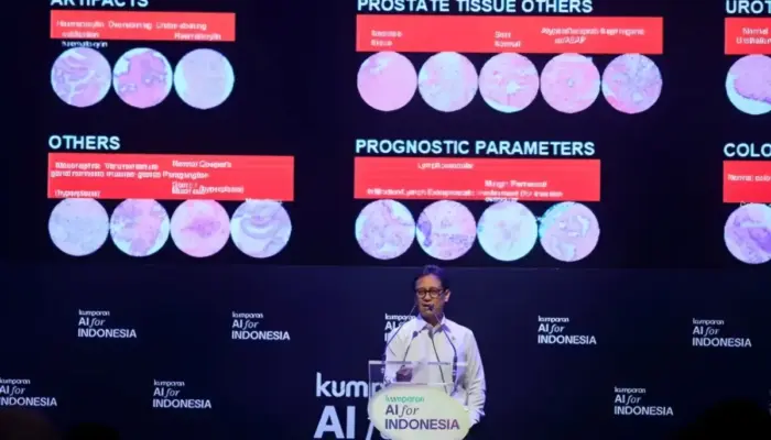 Menkes Budi Kembangkan AI Kesehatan untuk Deteksi Dini Stroke, TBC, dan Kanker