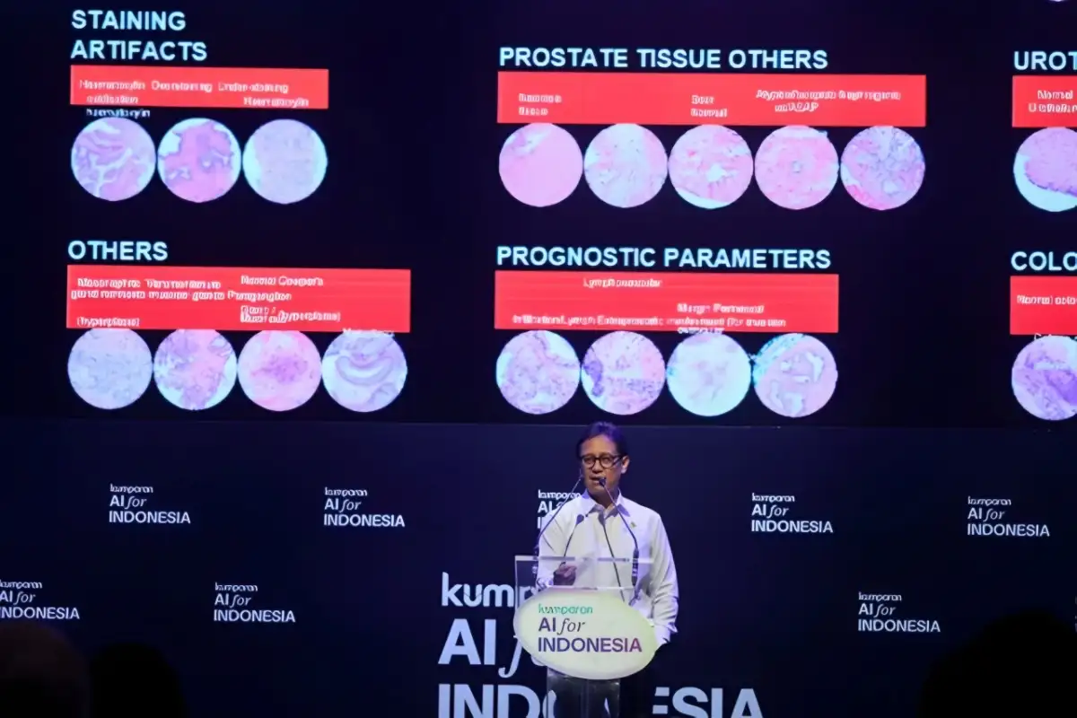 Menkes Budi Rencanakan AI untuk Membantu Dokter Deteksi Stroke dan Kanker