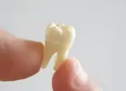 Apa Arti Mimpi Gigi Copot? Tak Selalu Pertanda Buruk