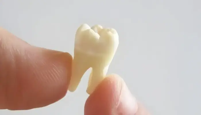 Apa Arti Mimpi Gigi Copot? Tak Selalu Pertanda Buruk