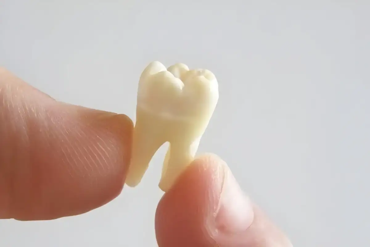 Apa Arti Mimpi Gigi Copot? Bisa Jadi Tanda Stres dan Banyak Tekanan Hidup