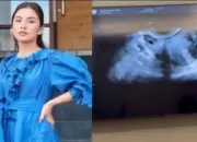 Chelsea Olivia Buka Suara soal Kabar Hamil Anak Ketiga, Ungkap Fakta di Balik USG ke Dokter Kandungan