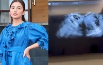 Chelsea Olivia Buka Suara soal Kabar Hamil Anak Ketiga, Ungkap Fakta di Balik USG ke Dokter Kandungan