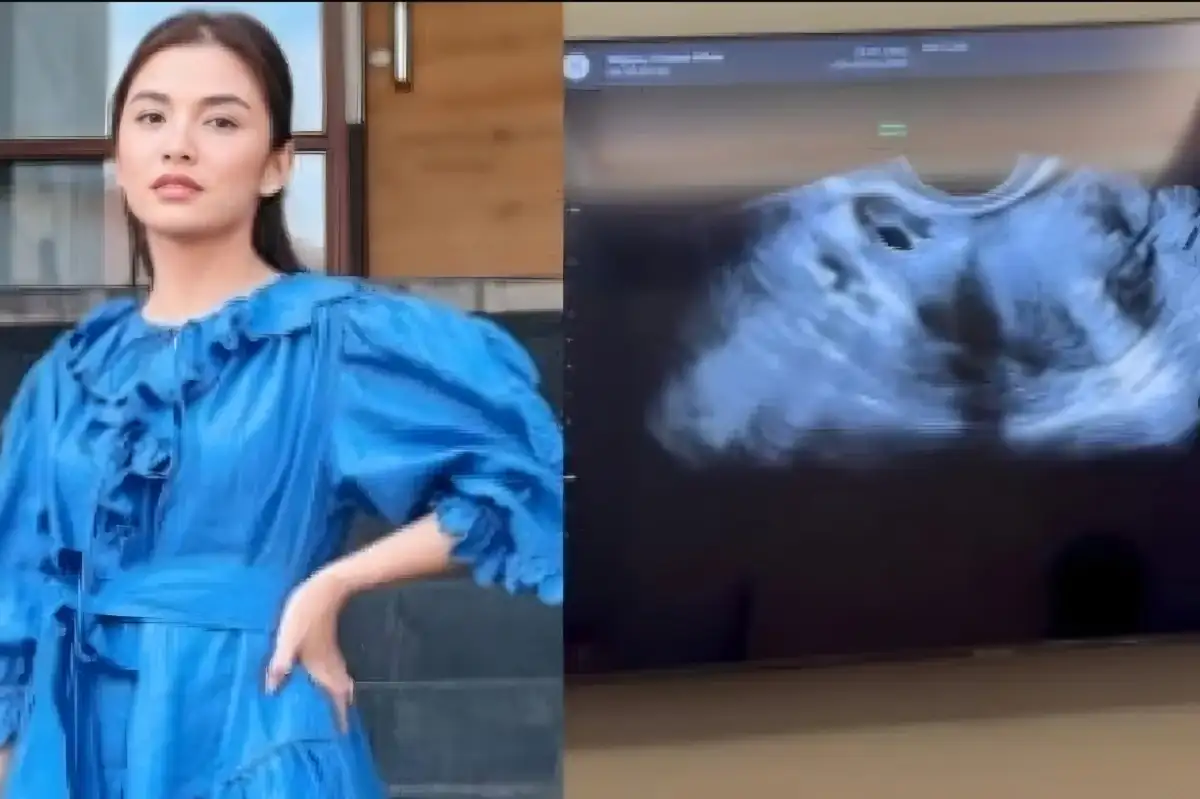 Chelsea Olivia Buka Suara soal Kabar Hamil Anak Ketiga, Ungkap Fakta di Balik USG ke Dokter Kandungan