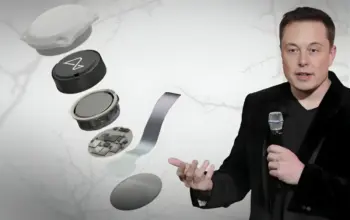 Neuralink Siap Masuk Produksi Massal, Implan Otak Era Baru Hadir 2026!