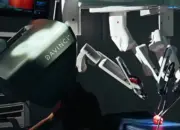 Sayatan Kecil, Tumor Ginjal Hilang! Keajaiban Robot Bedah Da Vinci XI