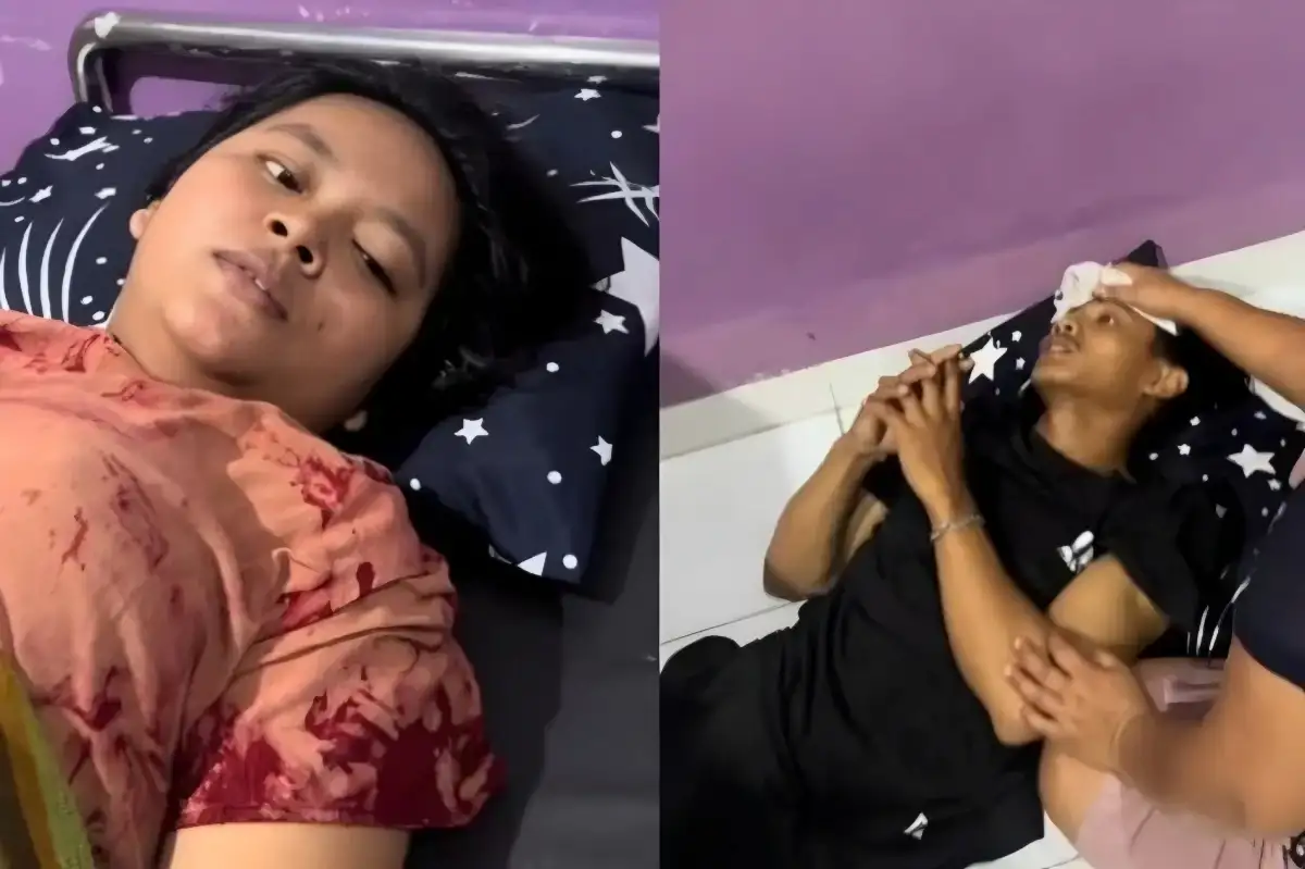 Suami Pingsan Saat Temani Istri Melahirkan, Aksi Anggi Jadi Sorotan Netizen