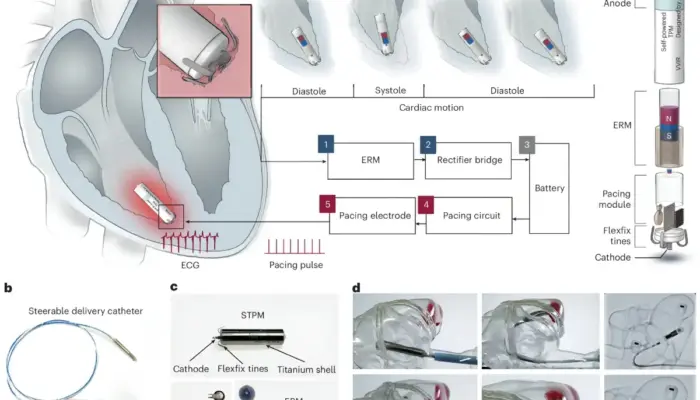Terobosan Peneliti China: Alat Pacu Jantung Mikro Berdaya Mandiri Seumur Hidup