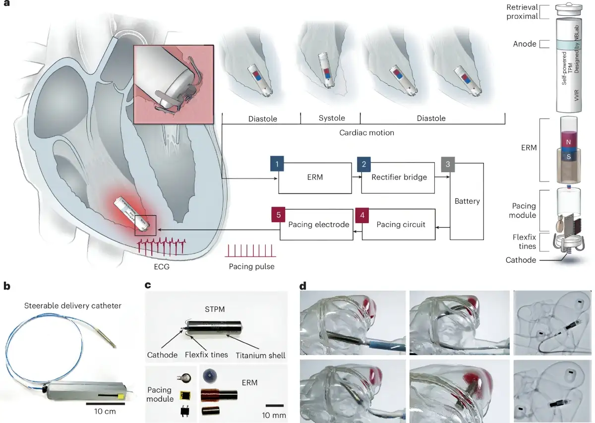 Terobosan Medis! Ilmuwan China Kembangkan Pacu Jantung Tanpa Baterai