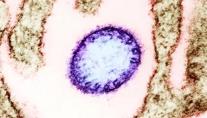 Virus Nipah Kembali Serang India, Ancaman Mematikan dengan Risiko Kematian Tinggi