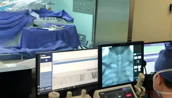 Robot Bedah Canggih di China Tembus Batas Efisiensi Operasi Otak