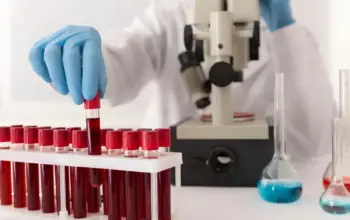 Terobosan Medis di Australia: Tes Darah Bisa Prediksi Risiko Kekambuhan Kanker Kepala dan Leher 4 Terobosan Medis: Ilmuwan Australia Kembangkan Tes Darah untuk Deteksi Risiko Kanker Kambuh