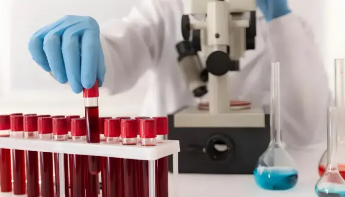 Terobosan Medis di Australia: Tes Darah Bisa Prediksi Risiko Kekambuhan Kanker Kepala dan Leher