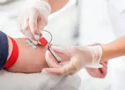 Tes Darah Baru Bisa Prediksi Peluang Umur Panjang Manusia dengan Akurasi 86% 10 Tes Darah Revolusioner Bisa Menaksir Peluang Hidup Lebih Lama Hingga 86% Akurat