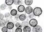 Badan Riset dan Inovasi Nasional Ungkap Risiko Penularan Hantavirus Usai Kasus Ditemukan di DKI Jakarta