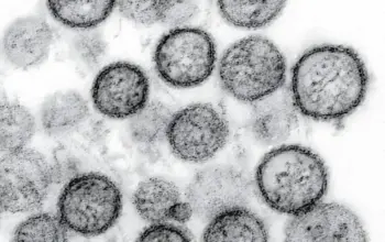 Badan Riset dan Inovasi Nasional Ungkap Risiko Penularan Hantavirus Usai Kasus Ditemukan di DKI Jakarta