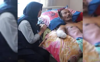 Gubernur Lampung Upayakan Bantuan Tangan Prostetik untuk Warga Korban Sengatan Listrik