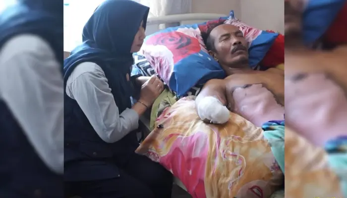 Gubernur Lampung Upayakan Bantuan Tangan Prostetik untuk Warga Korban Sengatan Listrik